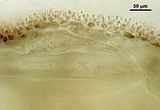 7 – Aspetto della zona corticale in sezione ottica